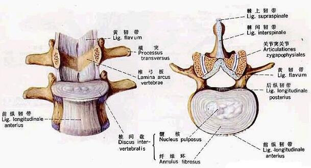 椎間盤突出橫切面圖