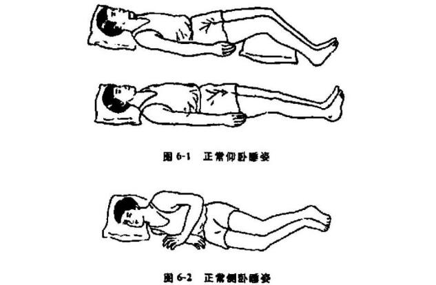 腰椎間盤突出正確睡覺姿勢圖