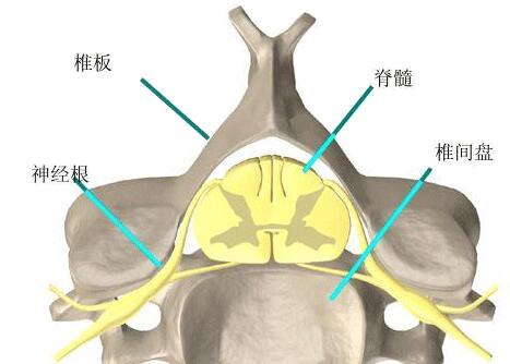 椎間盤(pán)突出結(jié)構(gòu)圖