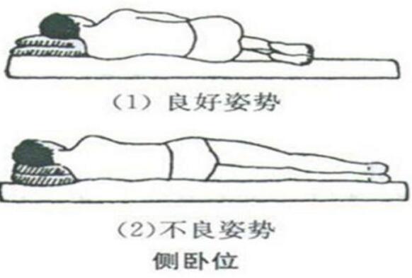 腰椎間盤突出正確睡覺姿勢圖