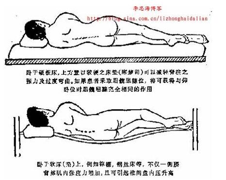 腰椎間盤突出正確睡覺姿勢圖