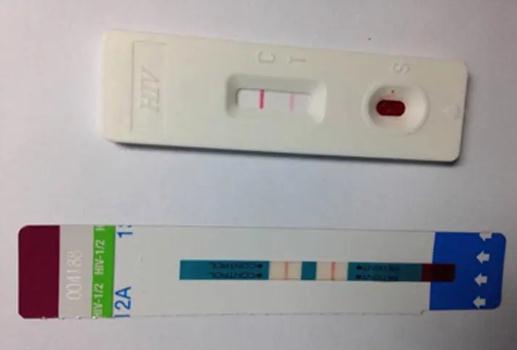 判斷是否有艾滋病，分享兩種在家也能自測艾滋病的方法